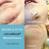 (2 1 1 Emergency Wound Closures Surgical Quality Laceration Repair Without Stitches - Think Ahead - Be Prepared