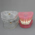 Smile1000 Dental Implant Teeth Model with Removable Teeth for Dental Professionals and Students