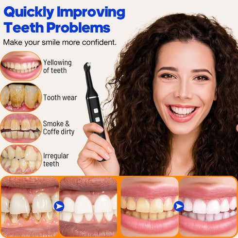 RRZIOM 5 5 Tooth Polisher, Rechargeable Teeth Polisher for Teeth Whitening and Cleaning Kit, Waterproof Tooth Polish