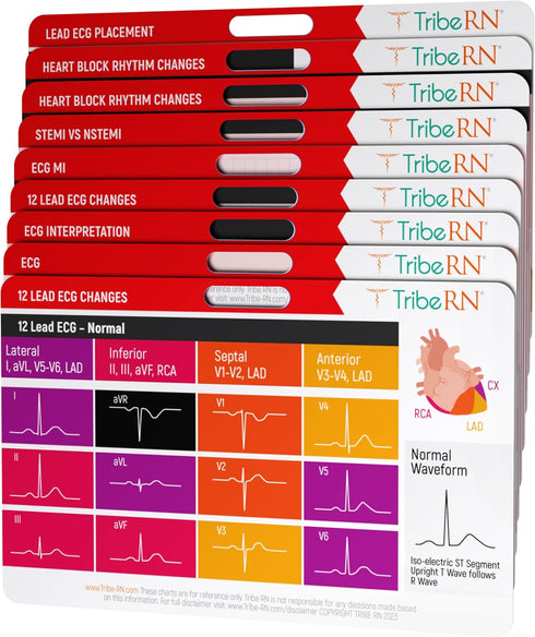 9 Badge Guru EKG/ECG Medical Flash Cards - Reference Cards for Nurses, Doctors, EMTs, Nursing Students and Med School