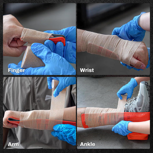36" 4.3" (6, RHINO RESCUE First Aid Splint X Orange-Gray, Keep Bones in Position Splint Bundle)