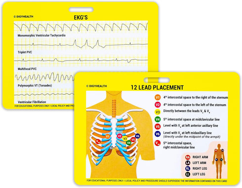 EKG 5 Card Set - Common Cardiac Rhythms Lead Placement Telemetry Cards for Nurses, EMTs, and Medical Students