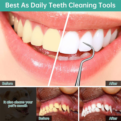 Professional Dental Scraper Tool, Medical Stainless Steel Dentist Pick, Dental Tarter Scraper for Tooth Stains Remover