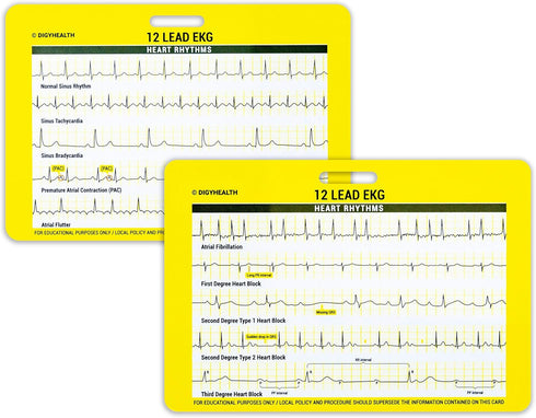 EKG 5 Card Set - Common Cardiac Rhythms Lead Placement Telemetry Cards for Nurses, EMTs, and Medical Students