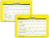 EKG 5 Card Set - Common Cardiac Rhythms Lead Placement Telemetry Cards for Nurses, EMTs, and Medical Students