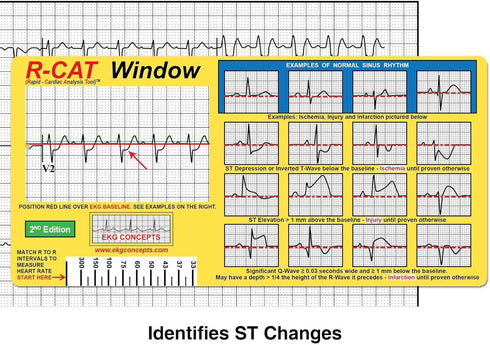 R-CAT EKG Window, 2nd Edition