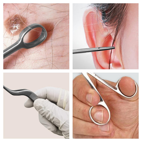 3.5" 5 Set, Hartman Alligator Forceps - High Quality, Long Lasting, Professional ENT Tools, Piece Ear Loop Design