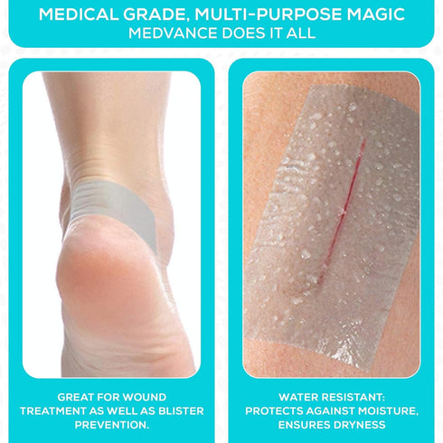 Medvance Soft Silicone Tape with Perforation for Easy Cut Size - 1" Width (3 Pack, 5 Yards)