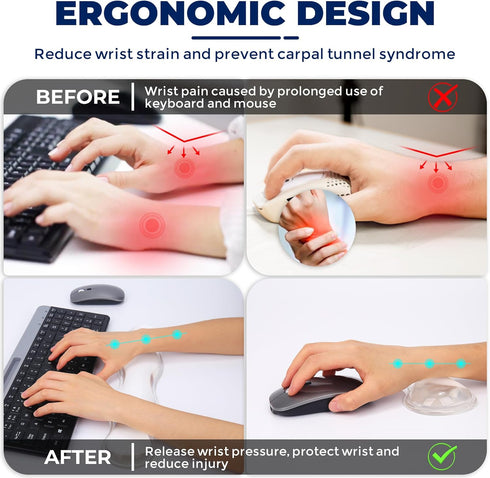 ABRONDA Set Gel Wrist Rest for Keyboard and Mouse, Wrist Rest for Keyboard, Mouse Wrist Support, Pain Relief, Cool
