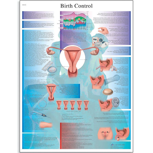 3B Scientific VR2591UU Birth Control Anatomical Chart (French) on Glossy, Non-Laminated Paper,