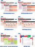 EKG Horizontal Badge 6 Card Set - ECG Telemetry Cards with EKG Ruler, Common Cardiac Findings, STEMI Leads