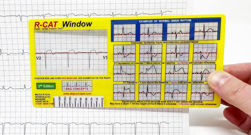 R-CAT EKG Window 2nd Edition by R-CAT
