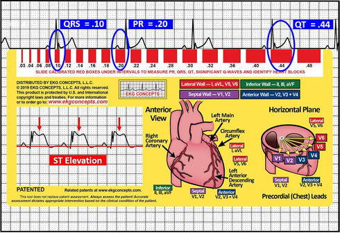 R-CAT EKG Window, 2nd Edition