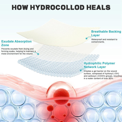 Ruzmmo (2in*5ft) Hydrocolloid Roll for Wound Care - Medical Grade Hydrocolloid Bandages with Flexible & Waterproof
