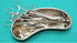 Kidney Tray Stainless Steel SS 304 X-Large Size 12 Inch, 1200 ml Kidney Shaped Emesis Basin Surgical Tray
