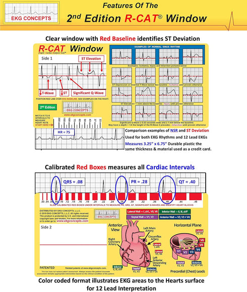 R-CAT EKG Window, 2nd Edition