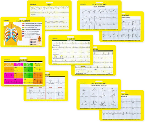 EKG 5 Card Set - Common Cardiac Rhythms Lead Placement Telemetry Cards for Nurses, EMTs, and Medical Students