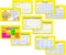 EKG 5 Card Set - Common Cardiac Rhythms Lead Placement Telemetry Cards for Nurses, EMTs, and Medical Students