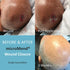 (2 1 1 Emergency Wound Closures Surgical Quality Laceration Repair Without Stitches - Think Ahead - Be Prepared