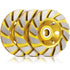 3 Pieces Turbo Row Diamond Grinding Cup Wheel for Concrete, Floors, Walls, Granite, Marble, Yellow
