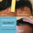 (2 1 1 Emergency Wound Closures Surgical Quality Laceration Repair Without Stitches - Think Ahead - Be Prepared