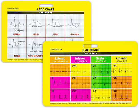 EKG 5 Card Set - Common Cardiac Rhythms Lead Placement Telemetry Cards for Nurses, EMTs, and Medical Students