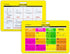 EKG 5 Card Set - Common Cardiac Rhythms Lead Placement Telemetry Cards for Nurses, EMTs, and Medical Students