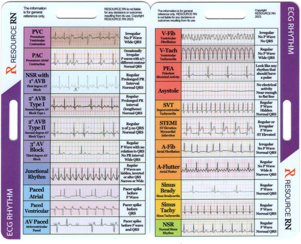 Resource RN EKG Rhythm Interpretation - Compact & Portable Reference Card Rapid Interpretation Guide