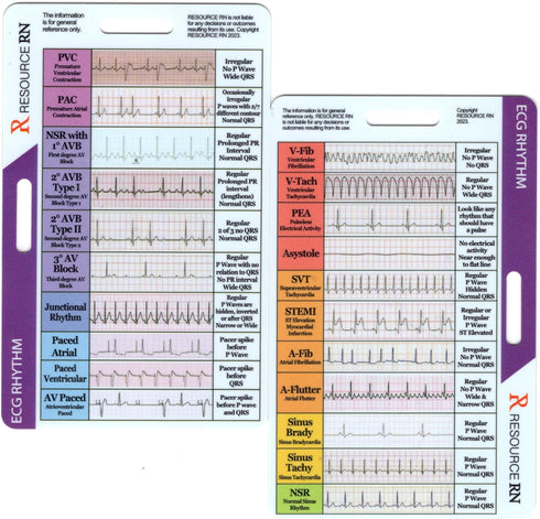 Resource RN EKG Rhythm Interpretation - Compact & Portable Reference Card Rapid Interpretation Guide Dual Horizontal