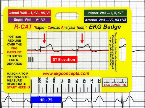 R-CAT EKG Identification Badge